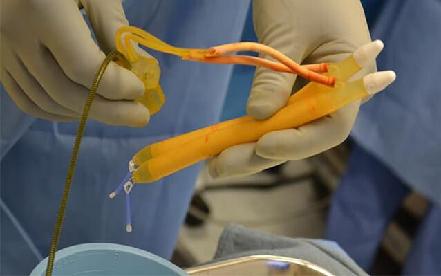 Implantate an der Penis