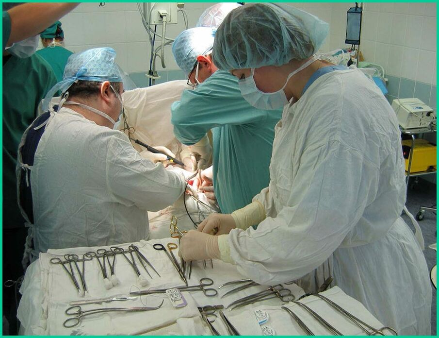 Penisvergréisserung mat Chirurgie oder Bakpulver, wat ass besser